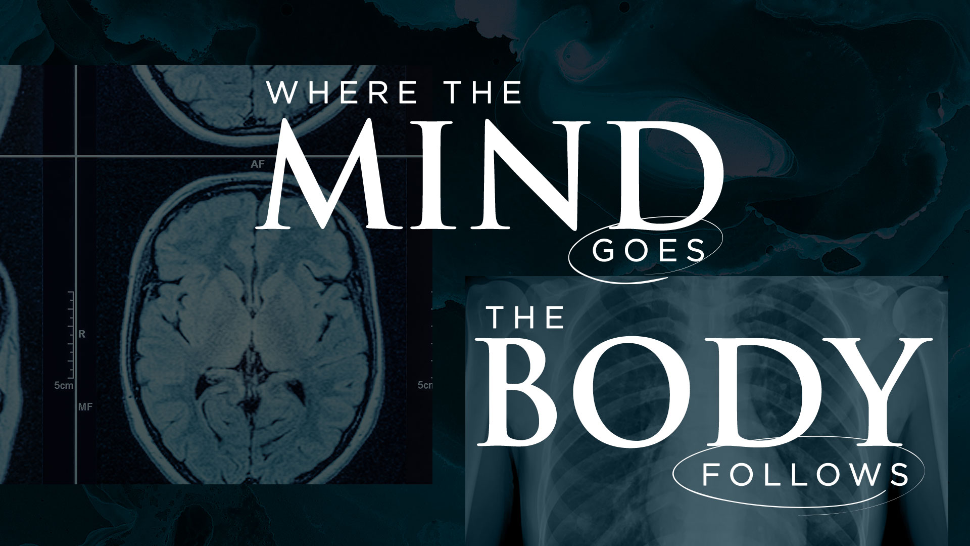 Where The Mind Goes, The Body Follows